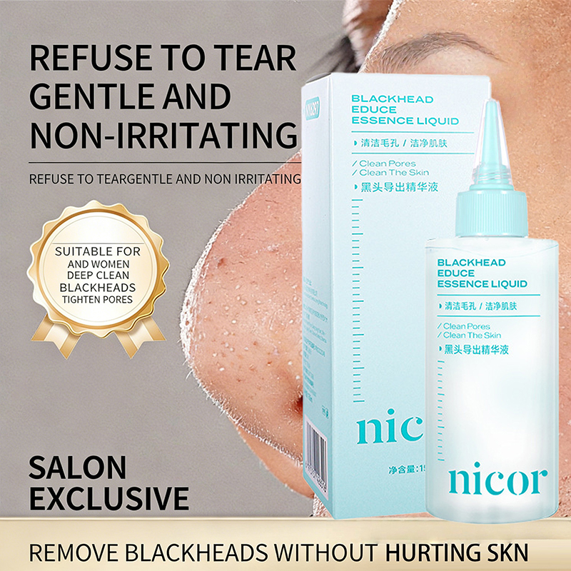 Essence Serum Toner - 150ml Blackhead Cleansing Essence Gentle Moisturizing